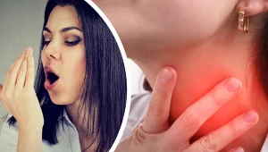 Nieświeży oddech z ust często pojawia się w zapaleniu migdałków lub w przypadku próchnicy