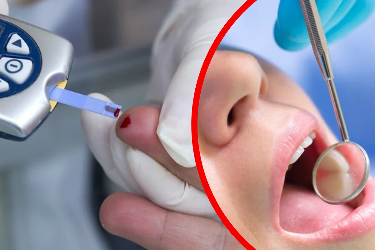 Wysokie stężenie cukru we krwi prowadzi do kwasicy ketonowej, jej charakterystycznym objawem jest zapach acetonu z ust