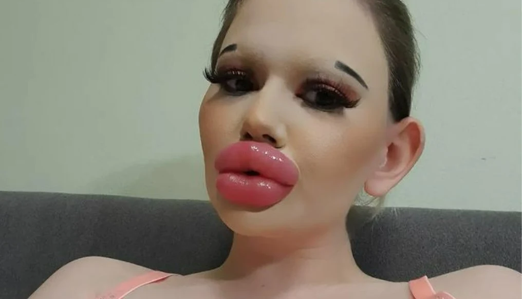 Ma "największe usta na świecie"