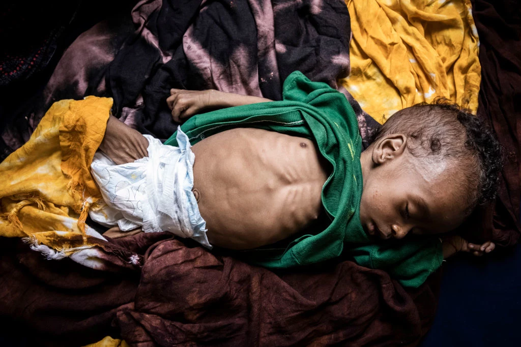 Szacuje się, że w 2011 roku w Somalii głód doprowadził do śmierci ponad ćwierć miliona osób