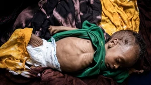 Dzieci umierają tu z powodu głodu, suszy i chorób. Ponad 700 małych ofiar