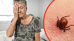 Borelioza to nie wszystko. To, co następuje potem, może dokuczać miesiącami