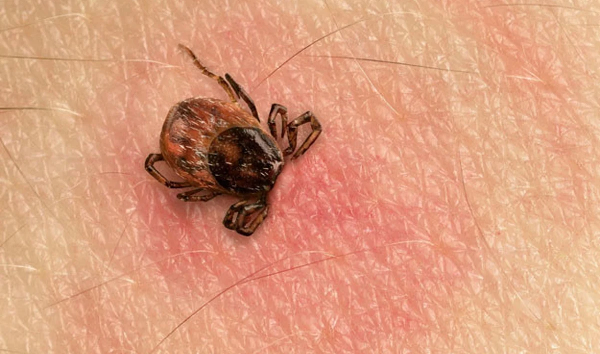 Borelioza to tylko jedna z wielu chorób odkleszczowych. Kleszczy nie wolno bagatelizować