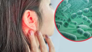 Infekcje ucha  środkowego mogą wywoływać piski, które mijają wraz z wyleczeniem infekcji