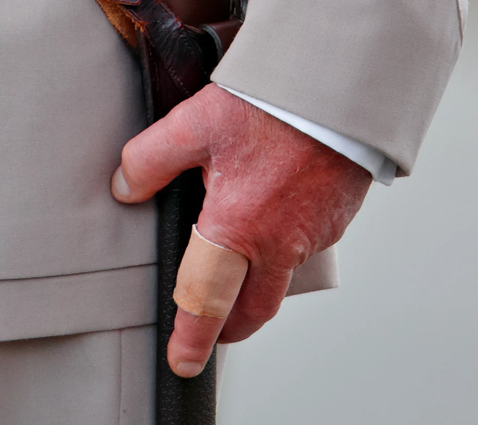 Ręka księcia Karola Ręka księcia Karola