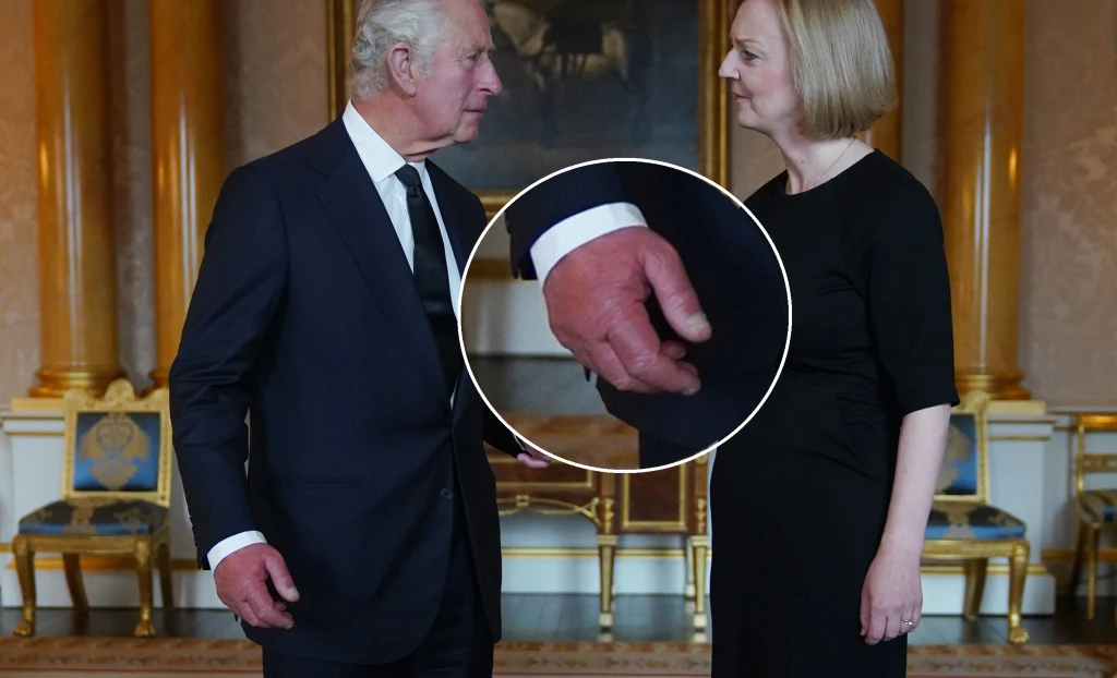 "Kiełbasiane palce" króla Karola III