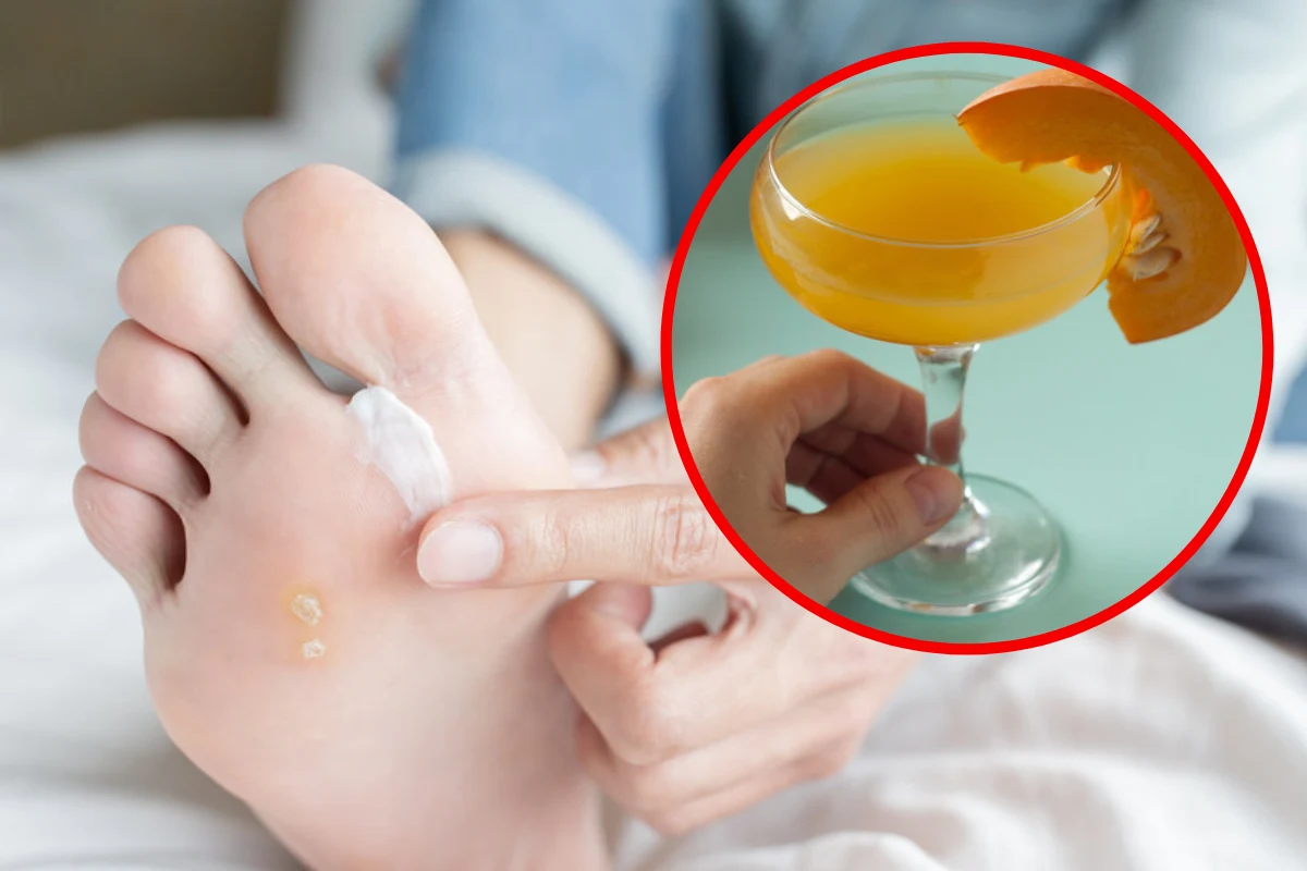 Nalewką z dyni można smarować skórę zmienioną chorobowo, no. w zakażeniu grzybicznym