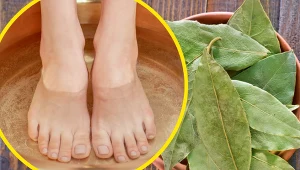 Kąpiele w wodzie z liściem laurowym lub okłady pomogą zlikwidować obrzęk w obrębie zdeformowanego stawu