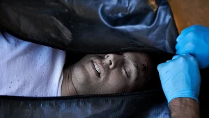 Sekcja zwłok wykonywana jest u pacjentów, u których przyczyna zgonu jest niejasna lub występuje podejrzenia popełnienia przestępstwa