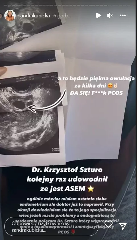 Sandra Kubicka pokazała badania USG Sandra Kubicka pokazała badania USG