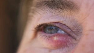 W walce z jęczmieniem można wykorzystać m.in. ciepłe okłady