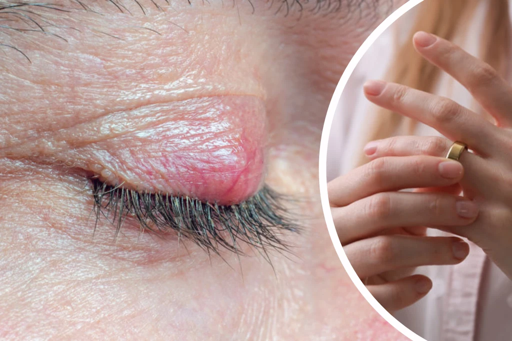 Pocieranie jęczmienia złotą obrączką nie jest najlepszym wyjściem