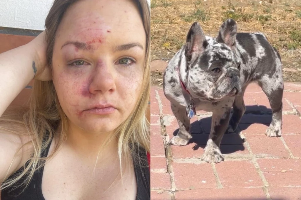 Amanda Hightower zamieściła na Facebooku zdjęcie po pobiciu przez złodziei psa Amanda Hightower zamieściła na Facebooku zdjęcie po pobiciu przez złodziei psa