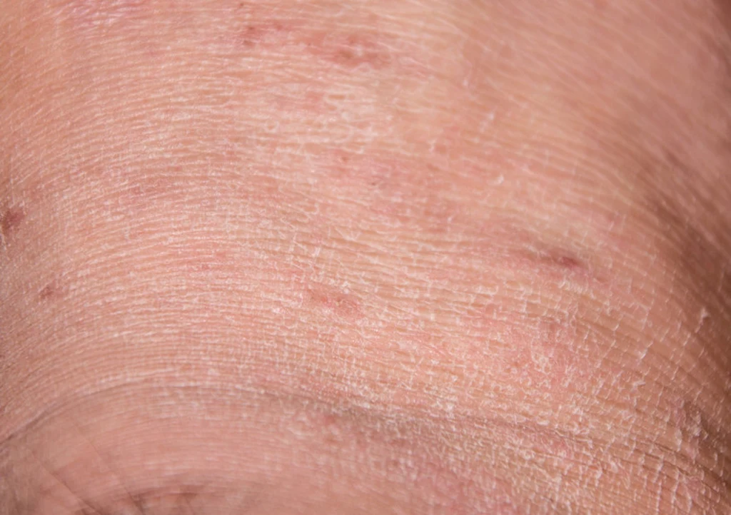 Skóra banknotowa jest cienka, sucha, pomarszczona, jakby postarzała