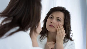 Tak rozpoznasz "obrzęk nerkowy". Zmiany widoczne na nogach, rękach i twarzy