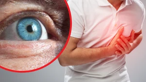 Istnieje zależność między wielkością tętniczek i żył, a także krętością naczyń krwionośnych w oku, a ryzykiem wystąpienia chorób układu krążenia