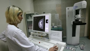 Mammografia pozwala dostrzec nawet najmniejsze zmiany nowotworowe i szybko zareagować. Zdj. ilustracyjne 
