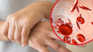 Bóle całego ciała, drętwienia rąk, biegunka oraz światłowstręt to objawy, które mogą sugerować porfirię