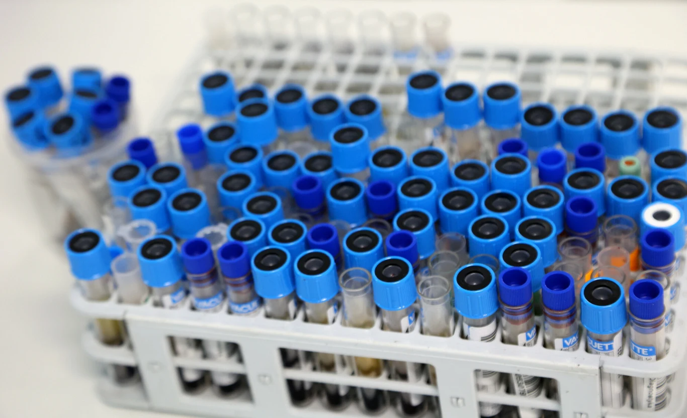 Diagności w czasie pandemii byli zajęci głównie walką z koronawirusem Diagności w czasie pandemii byli zajęci głównie walką z koronawirusem