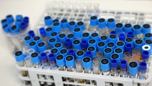 Diagności w czasie pandemii byli zajęci głównie walką z koronawirusem