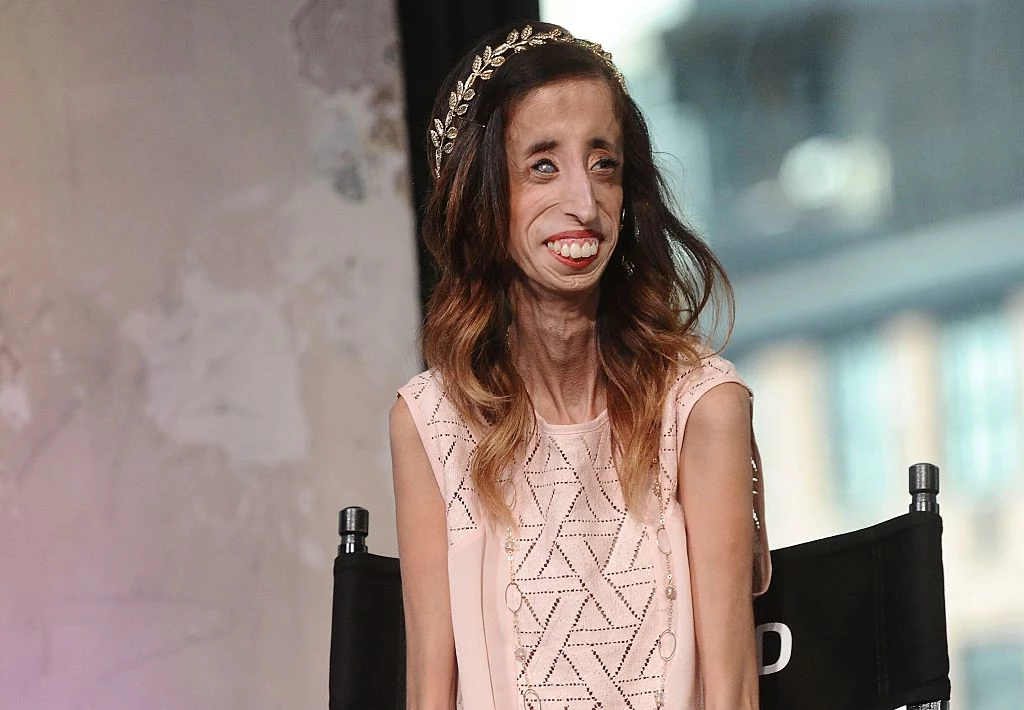 Lizzie Velásquez przeszła długą drogę. Pogodziła się z tym, jak wygląda