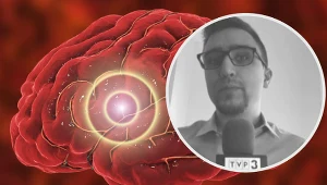 Młody dziennikarz TVP skarżył się na ból głowy. Na diagnozę czekał kilkanaście godzin, a dziś jest w śpiączce/TVP 3