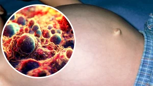 Potworniaki zbudowane są z komórek zarodkowych, które mają zdolność do przekształcania się w praktycznie wszystkie tkanki, z których zbudowany jest organizm człowieka