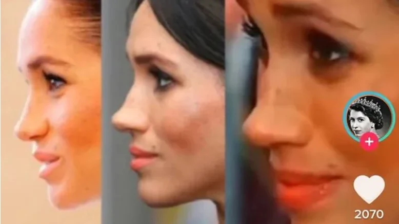 Nos Meghan Markle uległ zmianie? Nos Meghan Markle uległ zmianie?