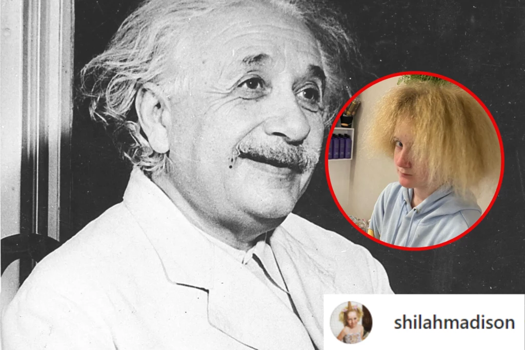 12-letnia Shilah cierpi na tę samą przypadłość co Albert Einstein