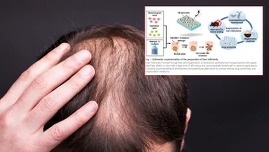 Biotechnolodzy wyhodowali mieszki włosowe (na małym zdjęciu grafika z publikacji w www.science.org)