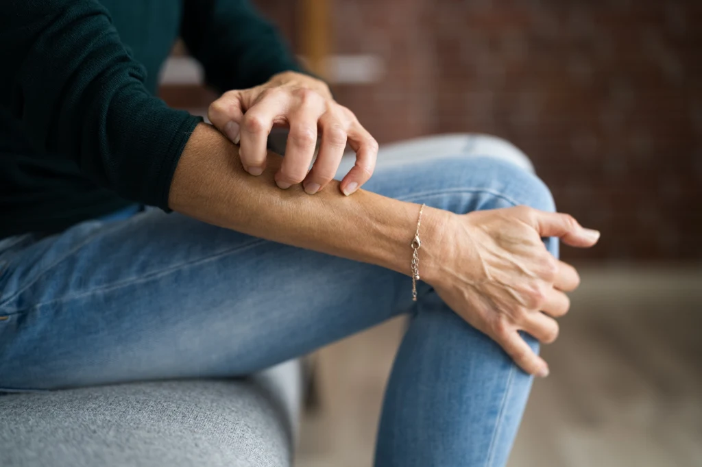 Gdy się stresujemy, skóra zaczyna swędzieć. To efekt działania hormonów, ale nie tylko Gdy się stresujemy, skóra zaczyna swędzieć. To efekt działania hormonów, ale nie tylko