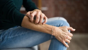 To, że się stresujesz, zdradzi twoja skóra. Ten objaw utrzymuje się godzinami