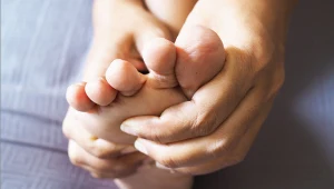 Cukrzyca ujawnia się na skórze. Zauważysz kilka zmian