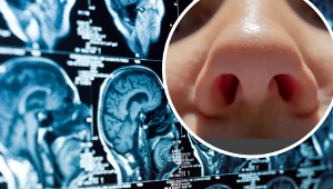 Dłubanie w nosie nie jest tak niewinnym nawykiem, jak mogłoby się wydawać