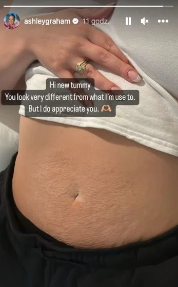 Ashley Graham pokazała rozstępy po bliźniaczej ciąży Ashley Graham pokazała rozstępy po bliźniaczej ciąży
