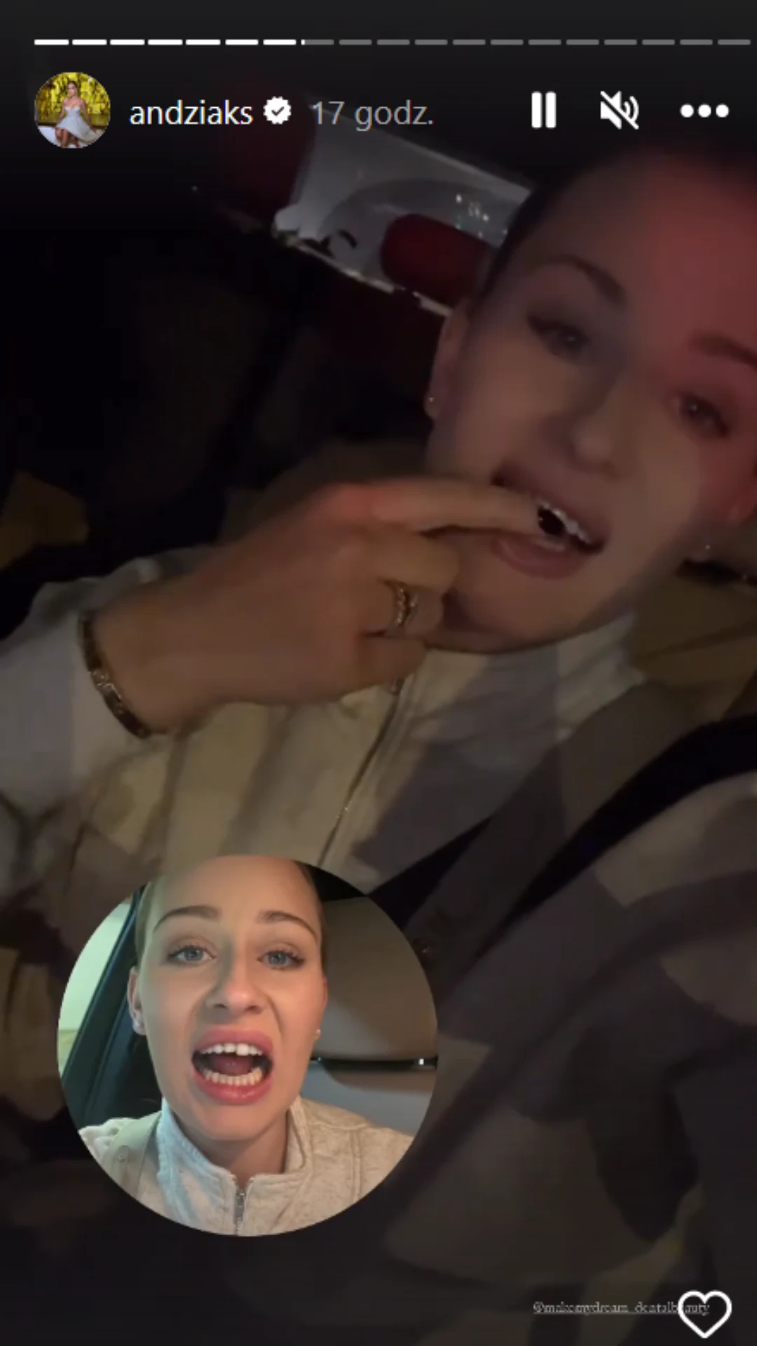 Andziaks straciła ząb. Swój "dramat" Youtuberka pokazała w sieci @andziaks/ Andziaks straciła ząb. Swój "dramat" Youtuberka pokazała w sieci @andziaks/