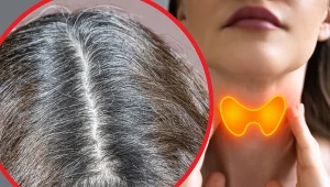 Łamliwe, puszące się i niesforne włosów mogą być efektem niedoborów witamin lub chorób tarczycy