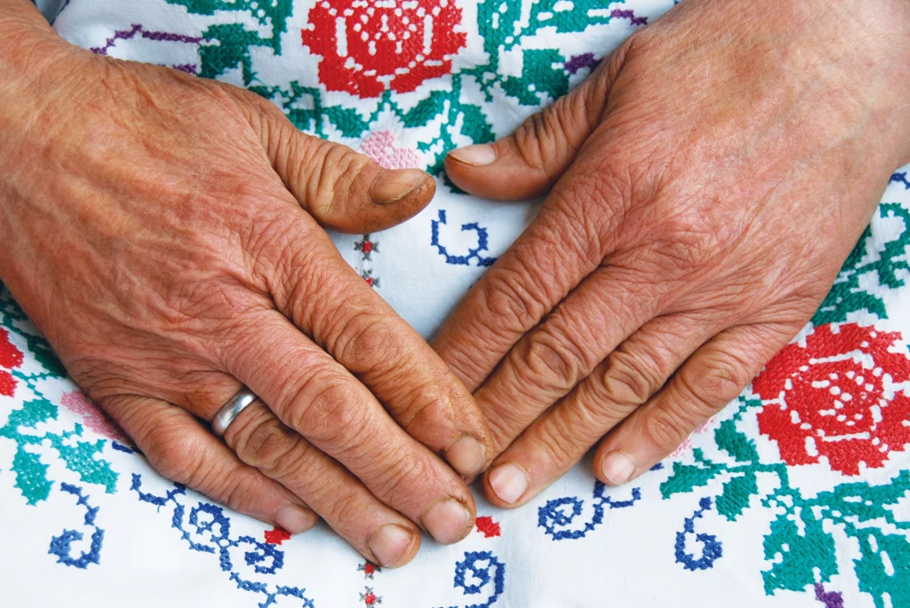 Zaniedbana skóra dłoni szybko pokazuje oznaki starzenia