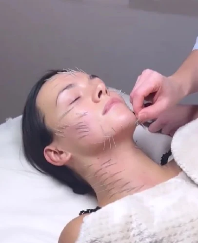 Paulina Krupińska cała w igłach. Szok, ze się na to zgodziła!