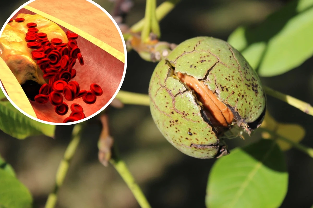 Orzechy włoskie obniżają zły cholesterol i pomagają wymiatać toksyny z organizmu