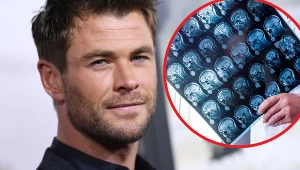 "Gen alzheimera" ma m.in. Aktor Chris Hemsworth. Z tego powodu przerwał karierę. Chce skupić się na zdrowiu i rodzinie 