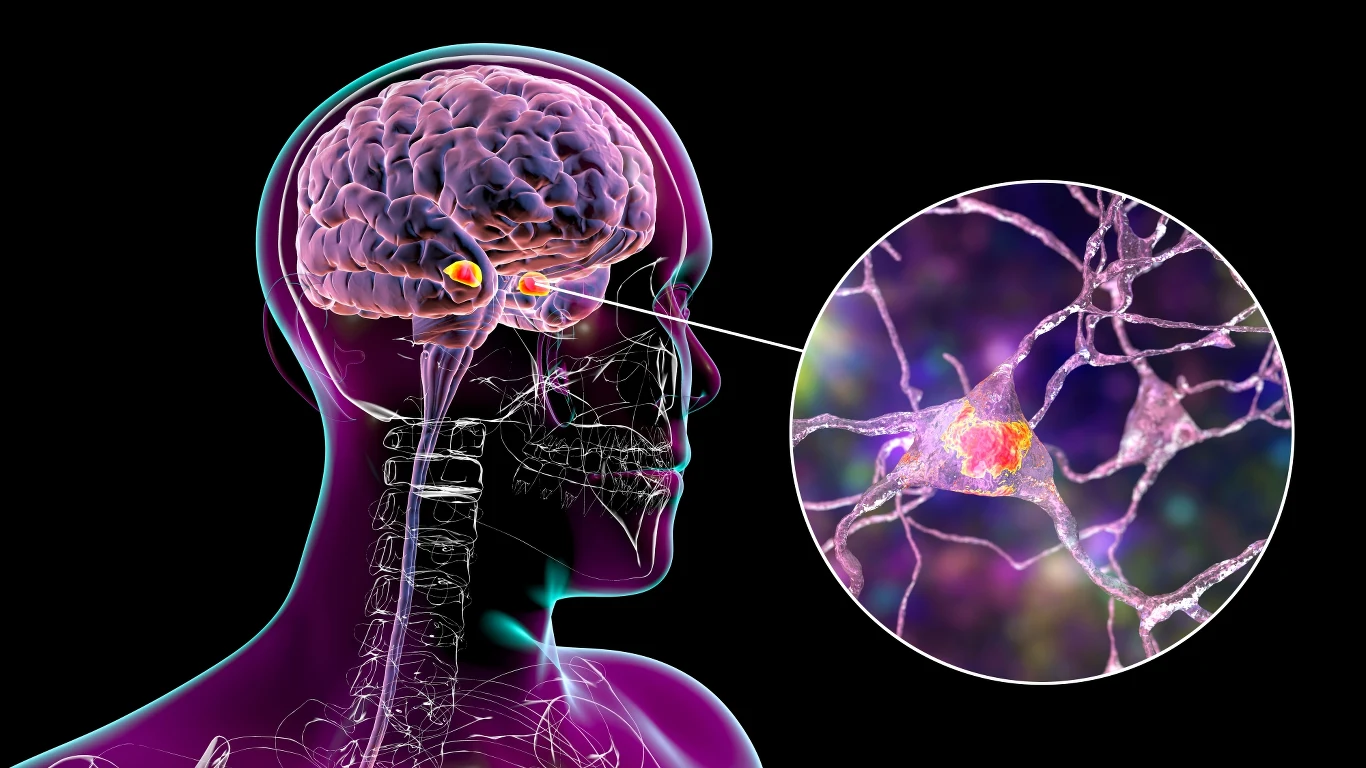 Mimo, że prace badaczy trwają już wiele lat, nadal nie odnaleziono skutecznego sposobu na choroby otępienne