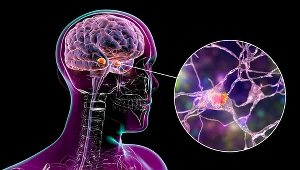 Nowy lek hamuje Alzheimera. Poruszające wyznanie pilota Sully'ego