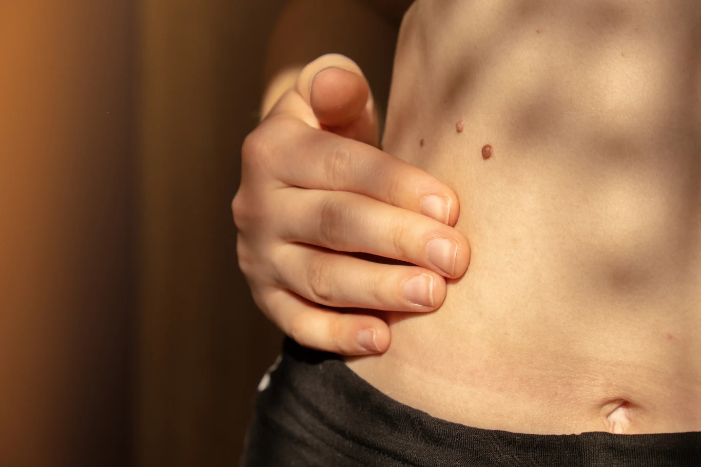 Czerniak nie zawsze pojawia się w miejscach, które wystawiamy na słońce