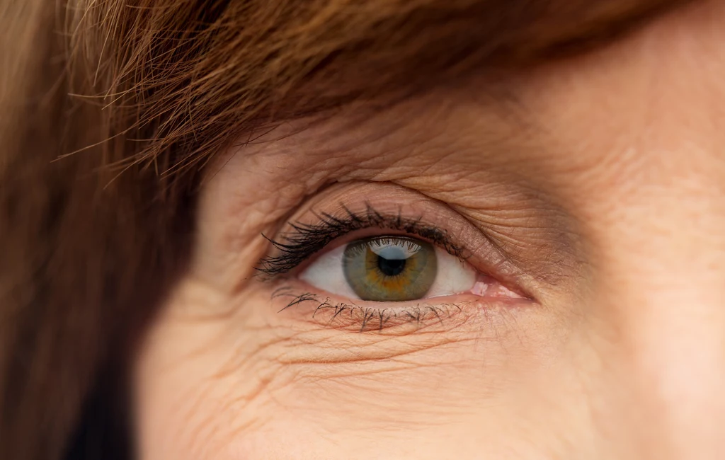 Skóra wokół oczu jest szczególnie narażona na powstawanie zmarszczek. Tam też pojawiają się najwcześniej