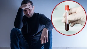 Pół roku leczyli go na łuszczycę. Zmarł dzień po usłyszeniu, że ma AIDS