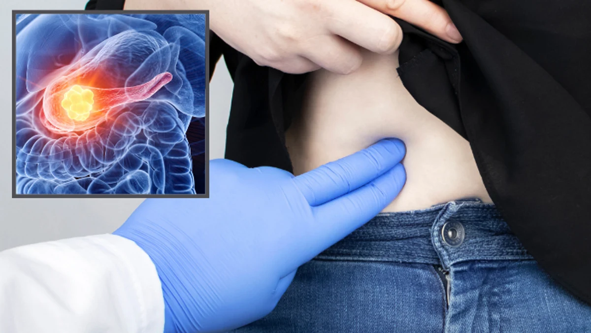 Choroby trzustki są trudno wykrywalne, nowa metoda może to zmienić Choroby trzustki są trudno wykrywalne, nowa metoda może to zmienić