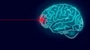 Przełomowe rozwiązanie laserowe może przyspieszyć prace nad terapiami chorób neurodegeneracyjnych (zdj. poglądowe)