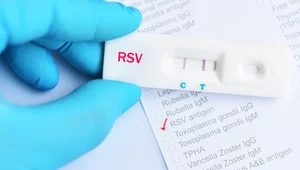 Wirus RSV. Zakażenie, objawy, ile trwa leczenie dzieci i dorosłych?