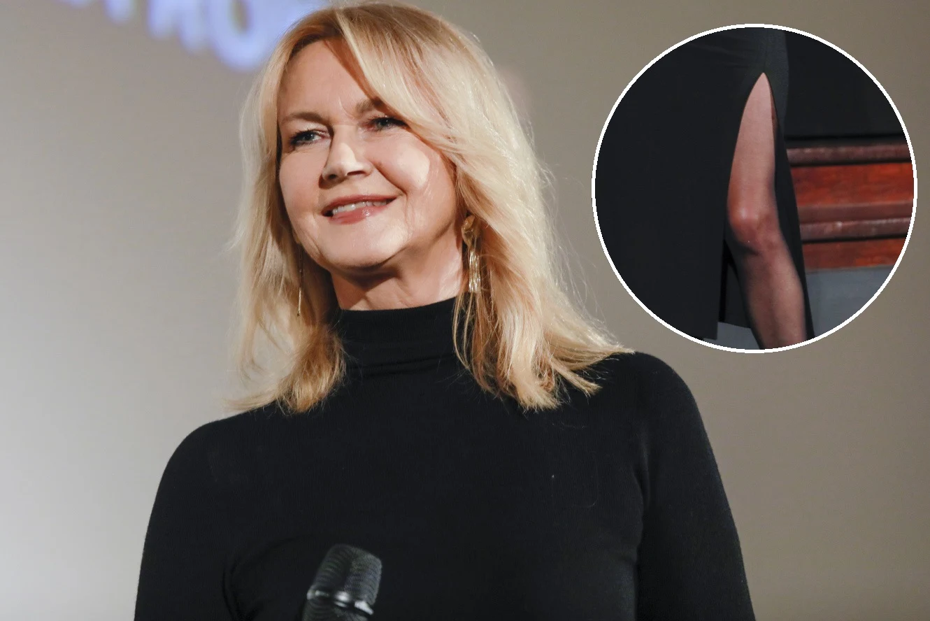 Grażyna Torbicka zaszlała z rozcięciem Grażyna Torbicka zaszlała z rozcięciem